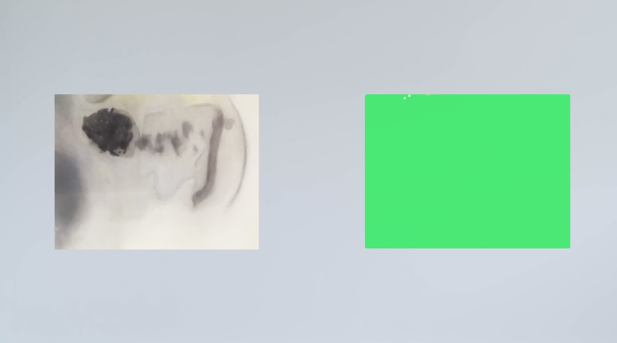 果醬吐司 Jam Toast，張儀君 Luna Cheong，霧視系列 Life Out of Focus Series，鋁板・油畫顏料・有機玻璃 · 2018